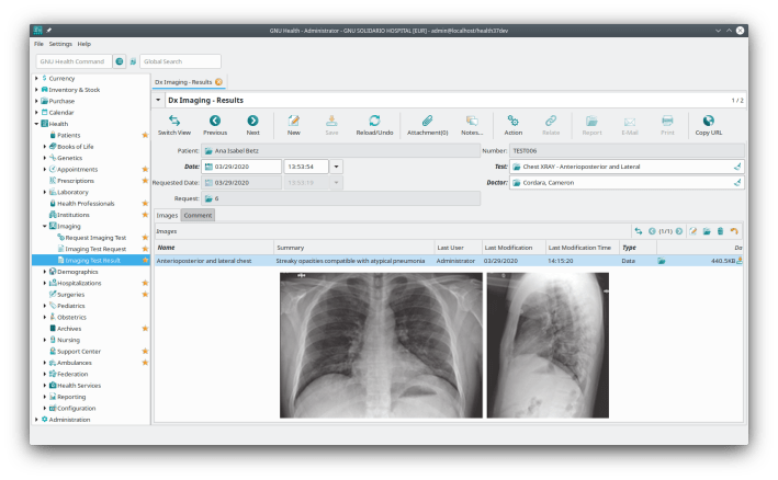 gnuhealth-dx-imaging-atypical_pneumonia_covid19